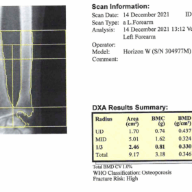 improper distal forearm scan acquisition